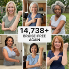DermaVive™ — Watch Bruises Vanish and Feel Your Skin Rise Stronger Every Day