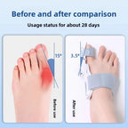 SoleAligner™ — Step Confidently with Comfort and Pain-Free Feet Every Day