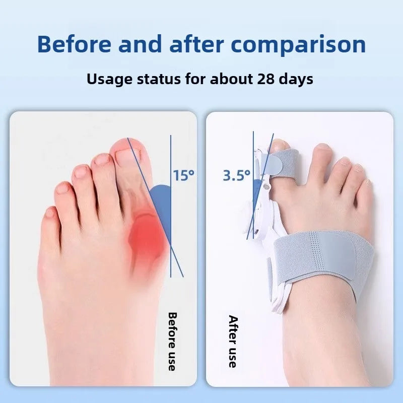 SoleAligner™ — Step Confidently with Comfort and Pain-Free Feet Every Day