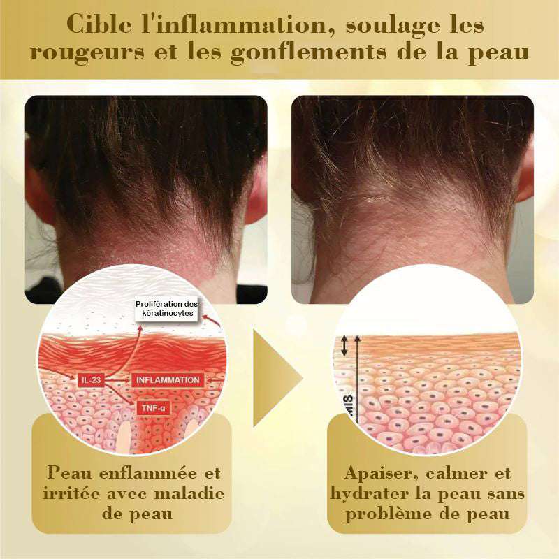 LuminaVex™ — Melt Away Skin Bumps and Unleash Your Natural Glow