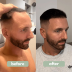 VitaTress™ — Unlock Bold, Head-Turning Hair That Feels Alive Every Day