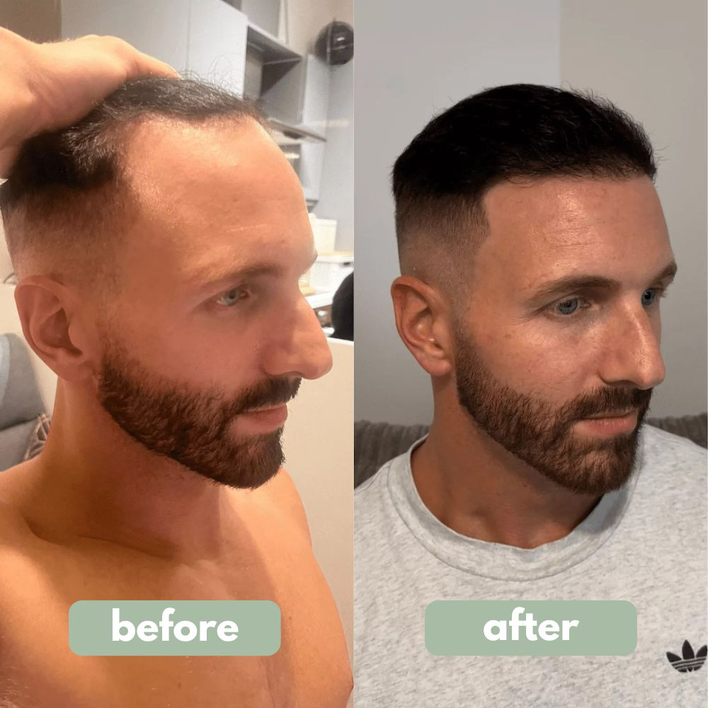 VitaTress™ — Unlock Bold, Head-Turning Hair That Feels Alive Every Day