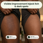 ViraDerm™ — Crush Fungus Fast and Reclaim Your Skin’s Power