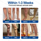 Veneliss™ Patch — Wake Up to Pain-Free, Beautiful Legs That Move You
