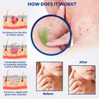 ClearVanta™ Rapid Fade Cream — Reveal Radiant, Flawless Skin Without Pain or Surgery