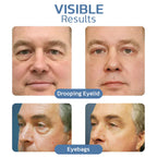 RameraLift™ — Wake Up to Younger, Brighter, and Firm Eyes Instantly (1+1 FREE TODAY!)