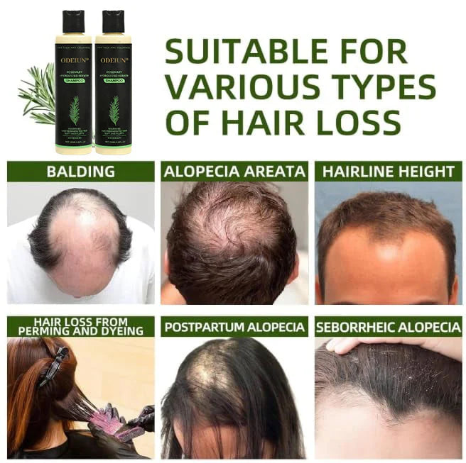RamoraRoot™ — Unlock Thick, Lush Hair That Feels Alive and Strong Every Day