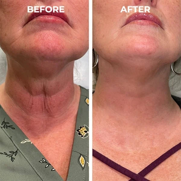 LumaVive™ — Instantly Reboot Your Skin’s Youthful Glow and Confidence (1+1 FREE TODAY!)