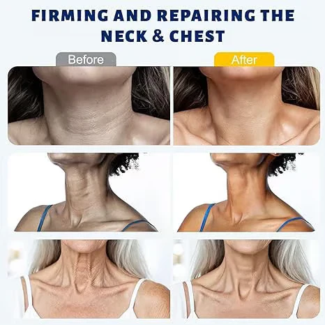 LuxeLift™ — Reveal a Firm, Radiant Neck That Demands Attention