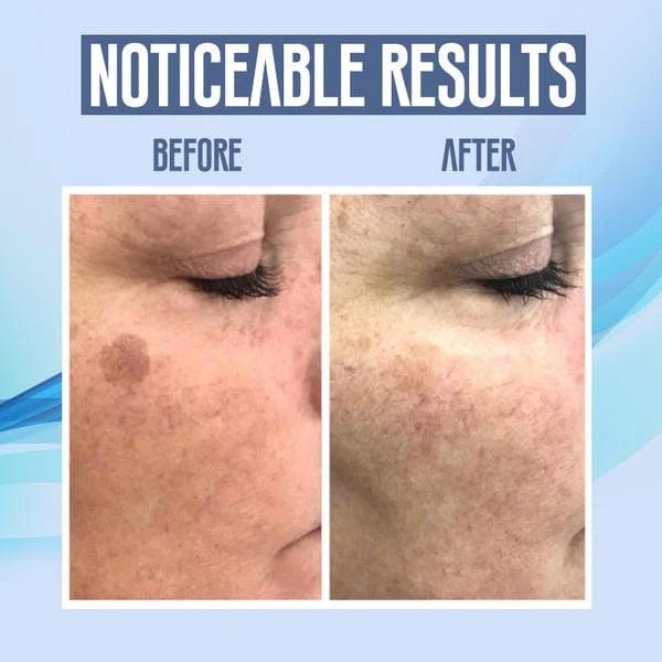 LumiClear™ Skin Pen — Instantly Erase Flaws and Love Your Reflection Again
