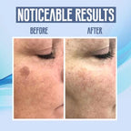 LumiClear™ Skin Pen — Instantly Erase Flaws and Love Your Reflection Again