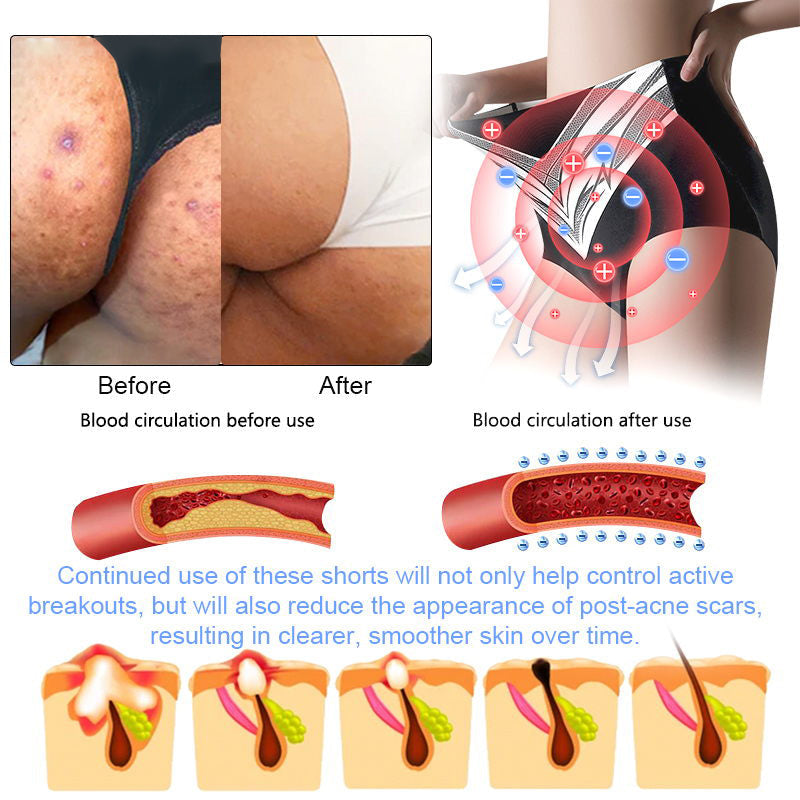 GlacioShape™ — Cozy Heat That Melts Fat, Smooths Skin & Frees You from Aches