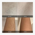 LumaSilk™ — Experience Effortless, Pain-Free Smoothness That Lasts for Weeks