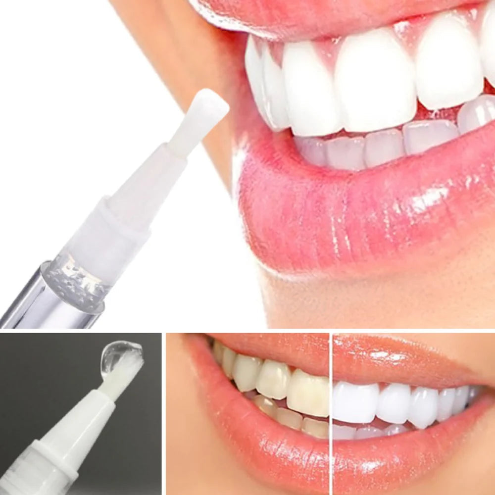 LumaLux™ — Instantly Boost Your Confidence with a Brighter, Radiant Smile