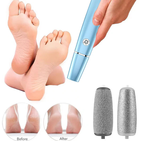 VelvetStep™ Electric Callus Remover — Unlock Silky, Pain-Free Feet You’ll Love to Show