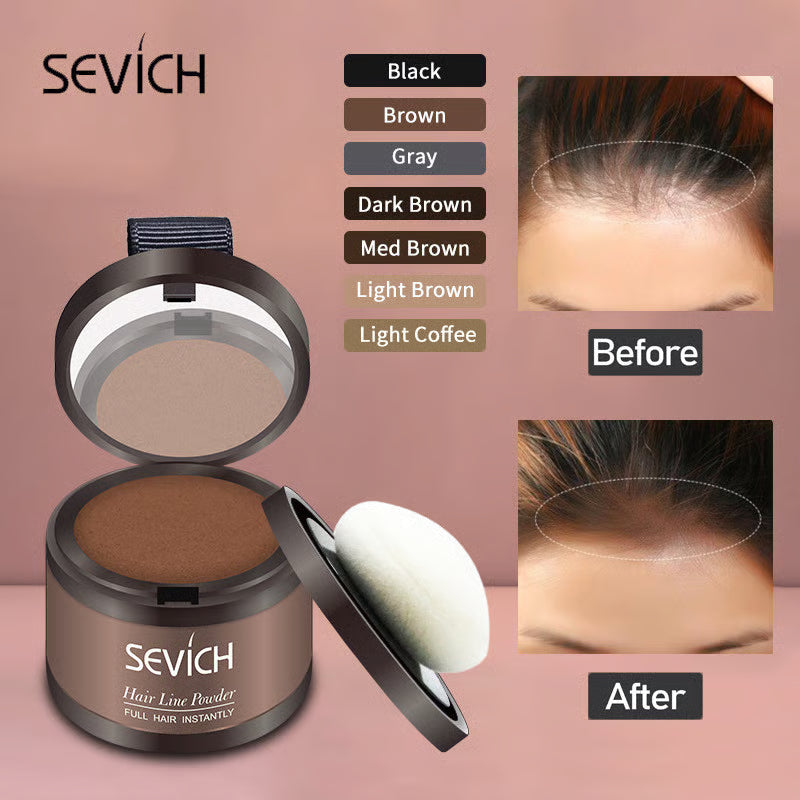 VivaRoot™ — Instantly Transform Your Hairline and Own Every Room