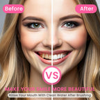 LuminaPure™ — Unleash a Radiant Smile That Commands Attention and Boosts Confidence