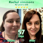 VioraLuxe™ 6-in-1 Nano Microneedle Patch — Melt Fat and Reveal Radiant, Youthful Confidence Fast
