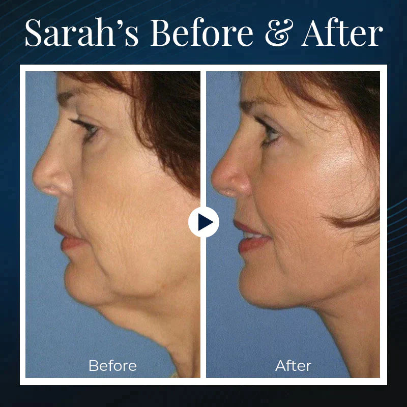 ViveLift™ — Effortless, All-Day Sculpting for a Jawline That Commands Attention