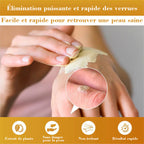 LuminaVex™ — Melt Away Skin Bumps and Unleash Your Natural Glow