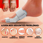 Stop Foot Pain Now™ — Relieve Bunion Agony and Reclaim Pain-Free Steps