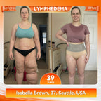VeloSculpt™ — Ignite Fat-Burning Heat for Effortless Slimming Confidence