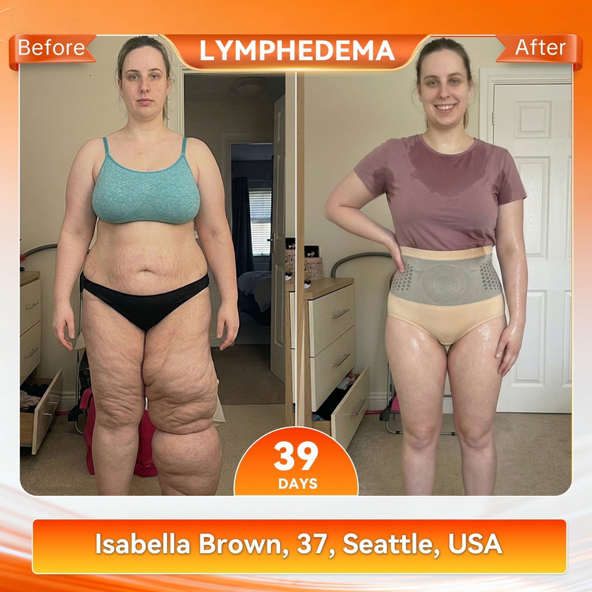 VeloSculpt™ — Ignite Fat-Burning Heat for Effortless Slimming Confidence