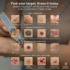 RamiraClear™ — Melt Away Blemishes Pain-Free and Reveal Radiant Skin in Just 7 Days