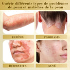 LuminaVex™ — Melt Away Skin Bumps and Unleash Your Natural Glow