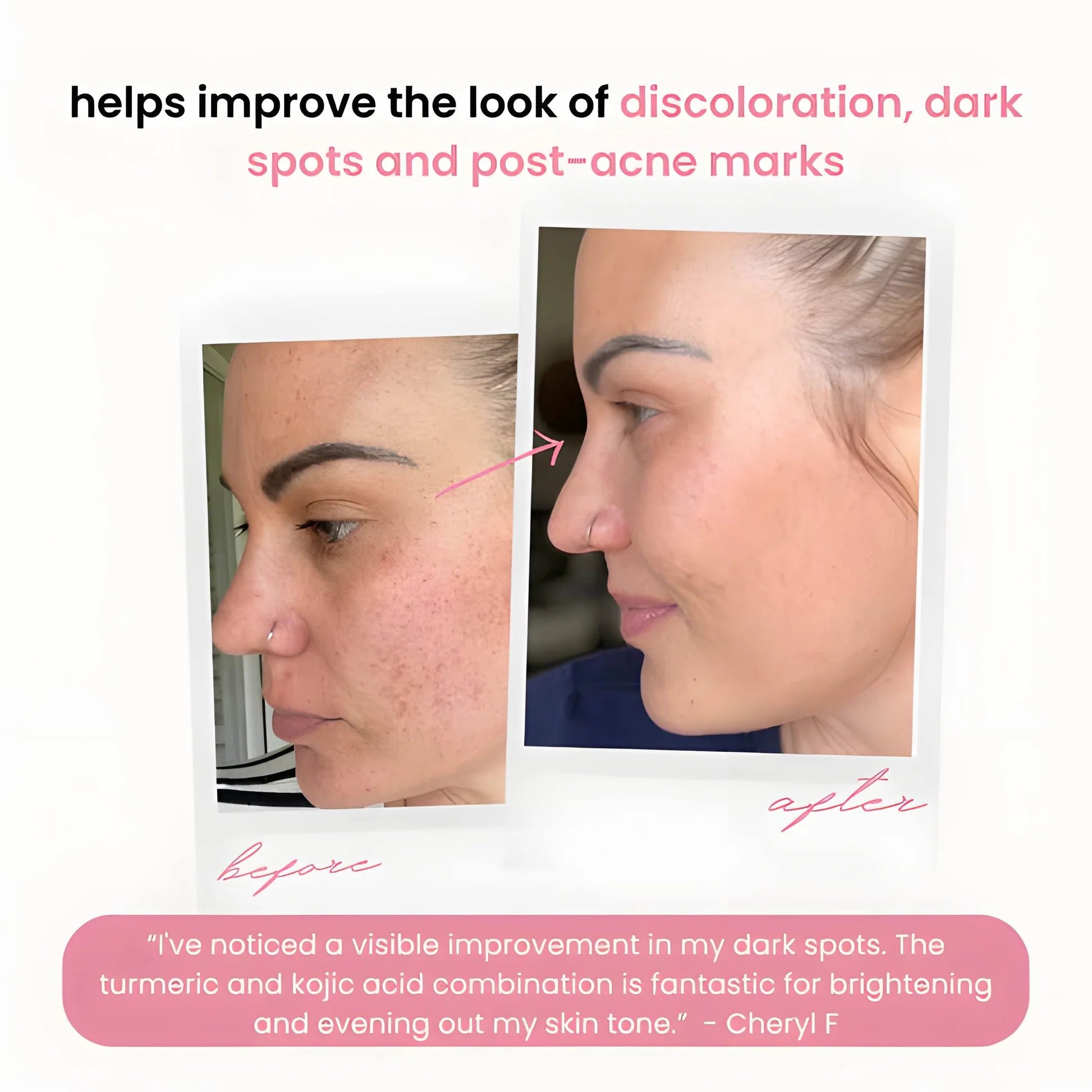 GlowLuxe™ — Wake Up to Radiant, Spot-Free Skin Every Day