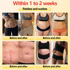 GlacioShape™ — Cozy Heat That Melts Fat, Smooths Skin & Frees You from Aches