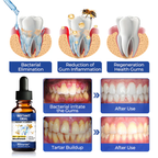 RevivaGum™ Elixir — End Gum Pain Fast and Reveal a Confident, Powerful Smile