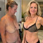 VivaCurve™ Advanced Nano Microneedle Patch — Unlock Fuller, Firmer Curves That Command Attention and Feel Naturally Alive
