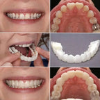 SmileSculpt™ — Own a Stunning, Confidence-Boosting Smile Instantly