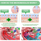 VioraLuxe™ 6-in-1 Nano Microneedle Patch — Melt Fat and Reveal Radiant, Youthful Confidence Fast