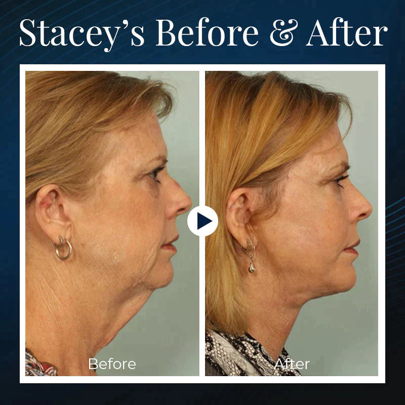 VioraLift™ Duo — Wake Up to a Sculpted Jawline and Snore-Free Sleep