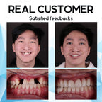 SmileNest™ — Rediscover Joy with a Denture Fit So Natural It Feels Like You Again