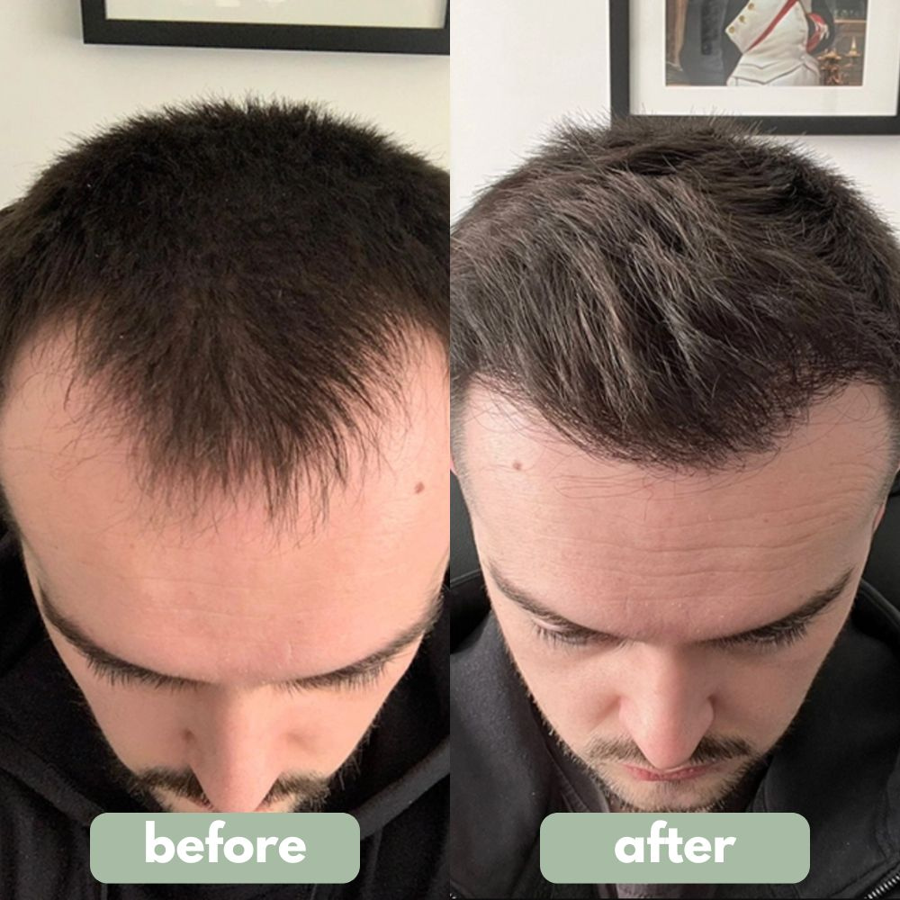 VitaTress™ — Unlock Bold, Head-Turning Hair That Feels Alive Every Day