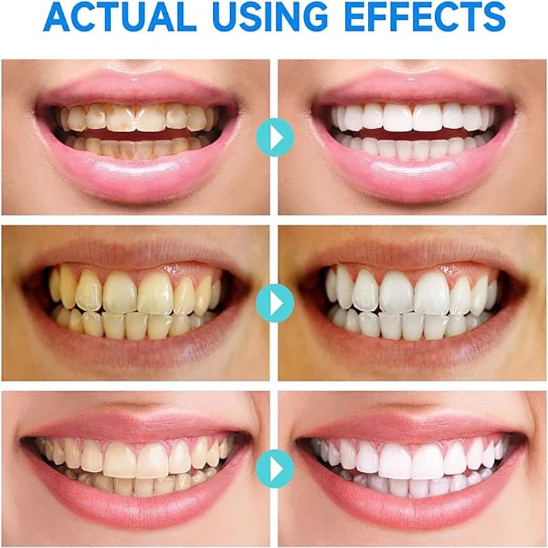 GlissenBright™ — Reveal a Radiant Smile and Heal Gums with Every Brush