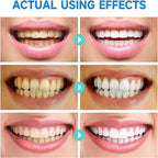 GlissenBright™ — Reveal a Radiant Smile and Heal Gums with Every Brush