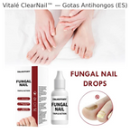 SereniNail™ Antifungal Repair Drops — Reclaim Gorgeous, Strong Nails You’re Proud to Show Off