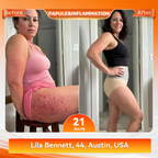 VeloSculpt™ — Ignite Fat-Burning Heat for Effortless Slimming Confidence