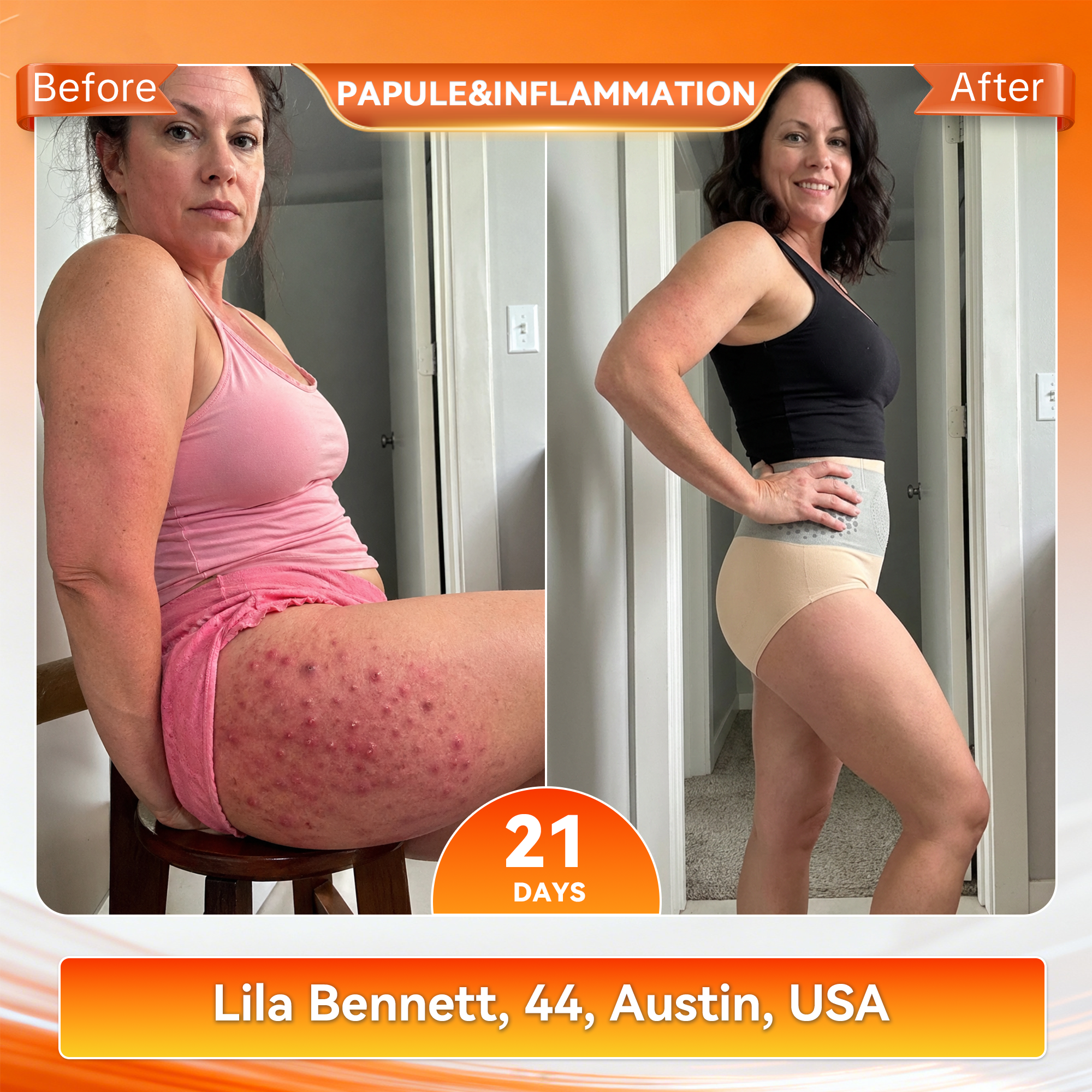 VeloSculpt™ — Ignite Fat-Burning Heat for Effortless Slimming Confidence