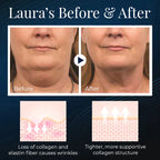ViveLift™ — Effortless, All-Day Sculpting for a Jawline That Commands Attention