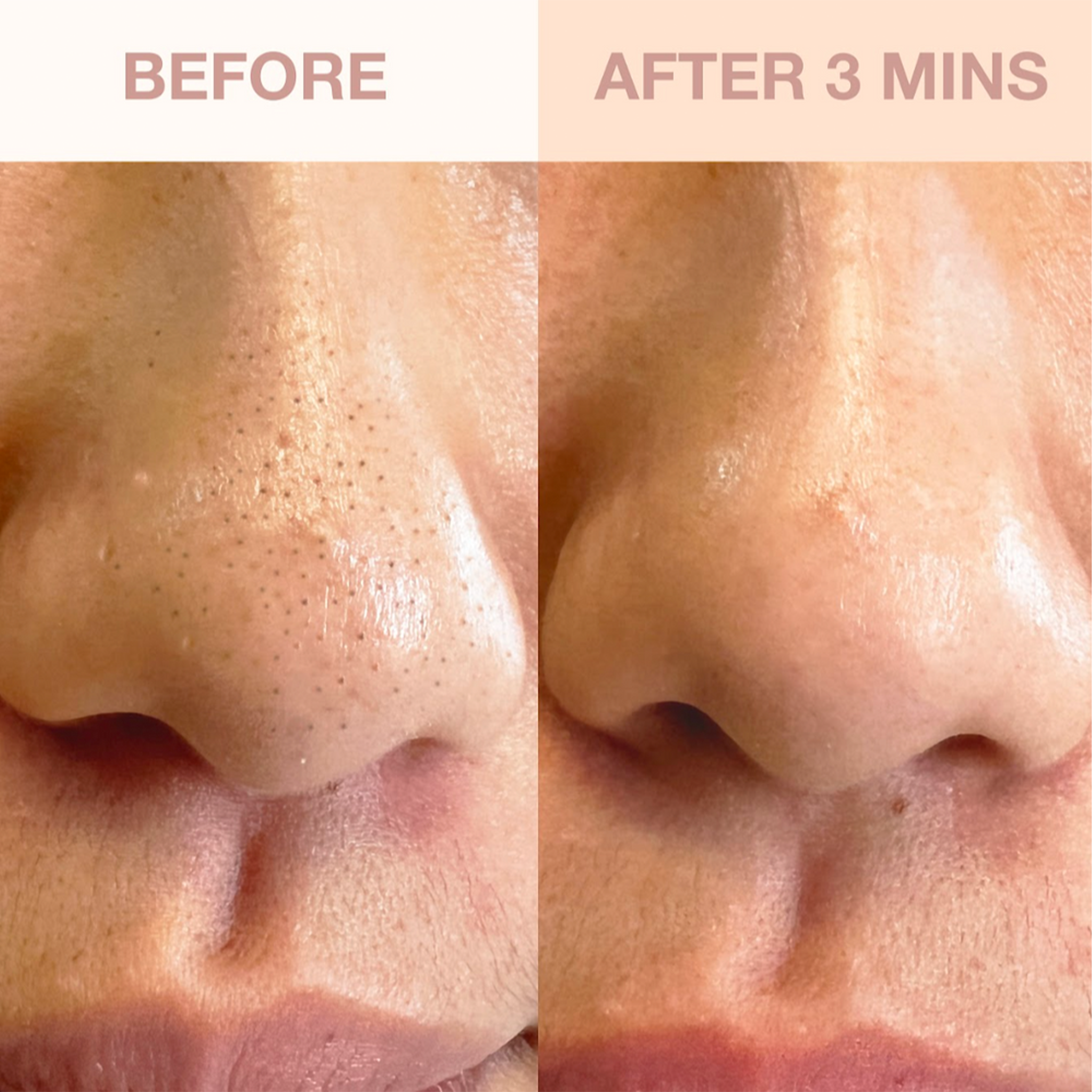 RamoraPure™ — Unlock Your Skin’s Natural Glow with Gentle, Expert Precision