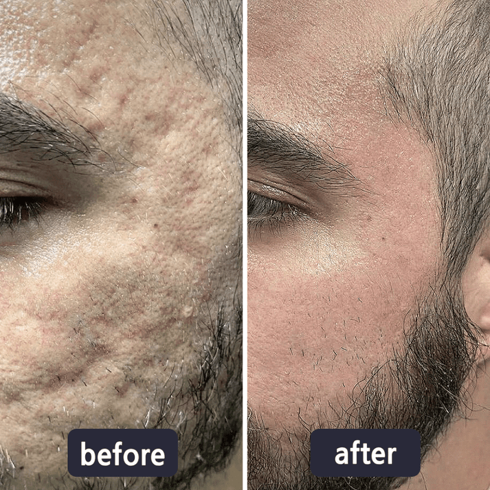 GlowSilk™ — Watch Scars Disappear and Reveal Radiant, Youthful Skin Instantly