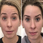 LumaVive™ — Instantly Reboot Your Skin’s Youthful Glow and Confidence (1+1 FREE TODAY!)
