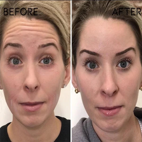 LumaVive™ — Instantly Reboot Your Skin’s Youthful Glow and Confidence (1+1 FREE TODAY!)