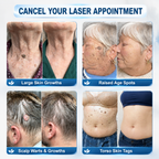 RamiraClear™ — Melt Away Blemishes Pain-Free and Reveal Radiant Skin in Just 7 Days
