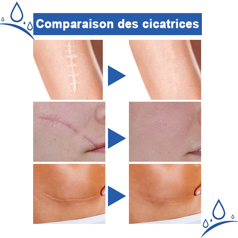 DermaLux™ Scar Renewal Gel — Unleash Flawless Skin and Confidence in Weeks